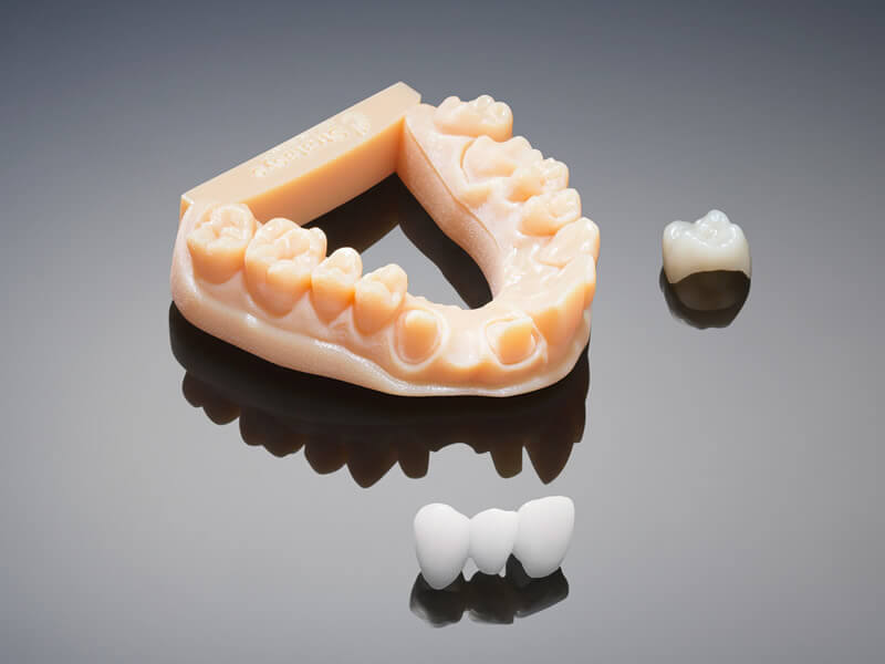 3d_printed_verodent_bridge_model